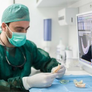 Chirurgia implantare guidata - interna 2